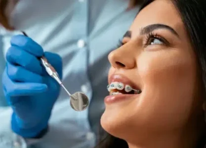 Aparat ortodontyczny