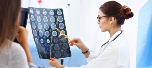 Czym jest padaczka ?