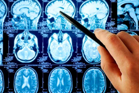 Neurolog i neurologia