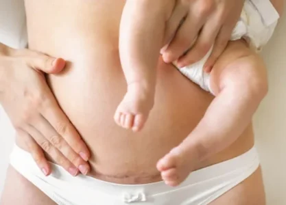 Fizjoterapia poporodowa