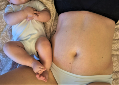 Rehabilitacja poporodowa