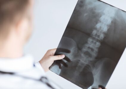 Diagnostyka radiologiczna