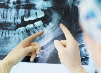 Diagnostyka radiologiczna